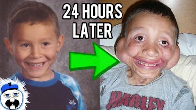 15 Kids Who Survived The Impossible